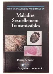 Tests de diagnostic par l'image dans les maladies sexuellement transmissibles