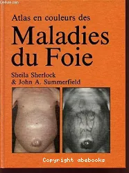 Maladies du foie