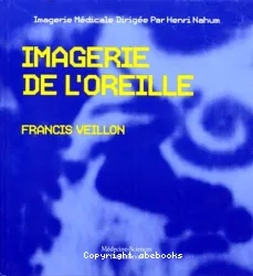 Imagerie de l'oreille