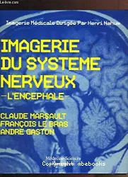 Imagerie du système nerveux