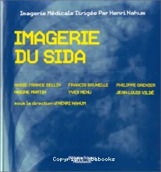 Imagerie du sida