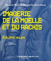 L'Imagerie de la moelle et du rachis