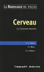 Cerveau